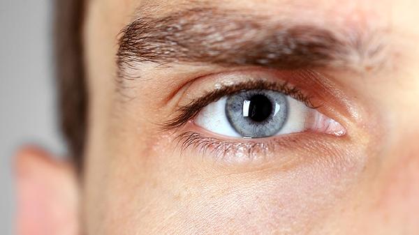 眼一单一双让人崩溃？5种眼皮尴尬症你中了几个