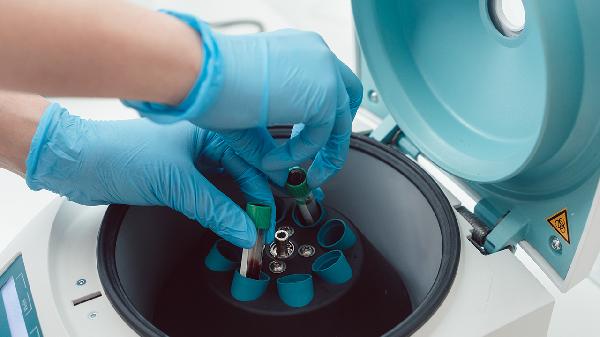 血常规检查能查出早期糖尿病吗