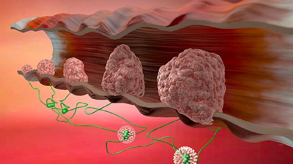 液基细胞学检查能查hpv吗