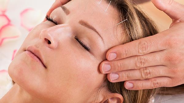 针灸可以治痛经吗