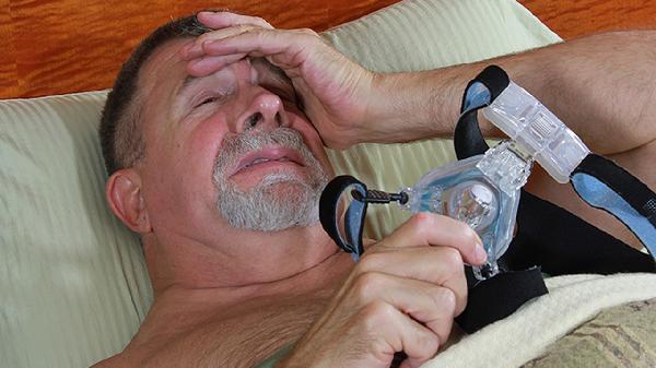 重度中枢性睡眠呼吸暂停