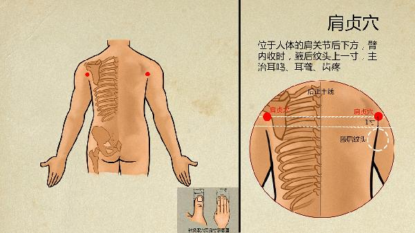中医治疗腺肌症的最佳治疗方法