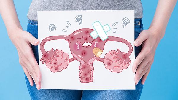 老婆子宫颈炎怎么办