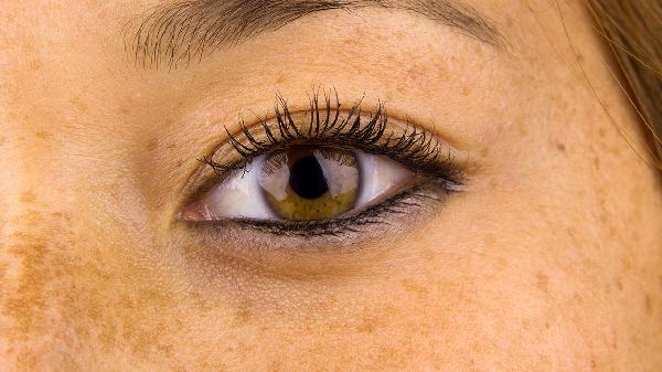祛斑的中药材有哪些