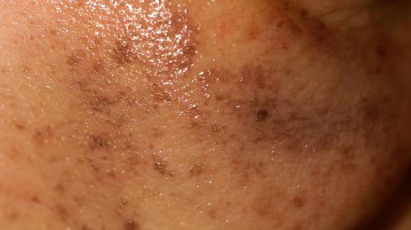 脸上斑点多显老?试试这几个日常小方法,轻松白回来。