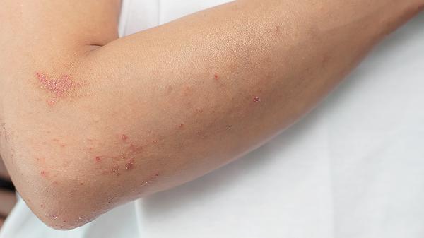 为什么女人“那里”痒得慌?或与这4个病有关,有必要了解